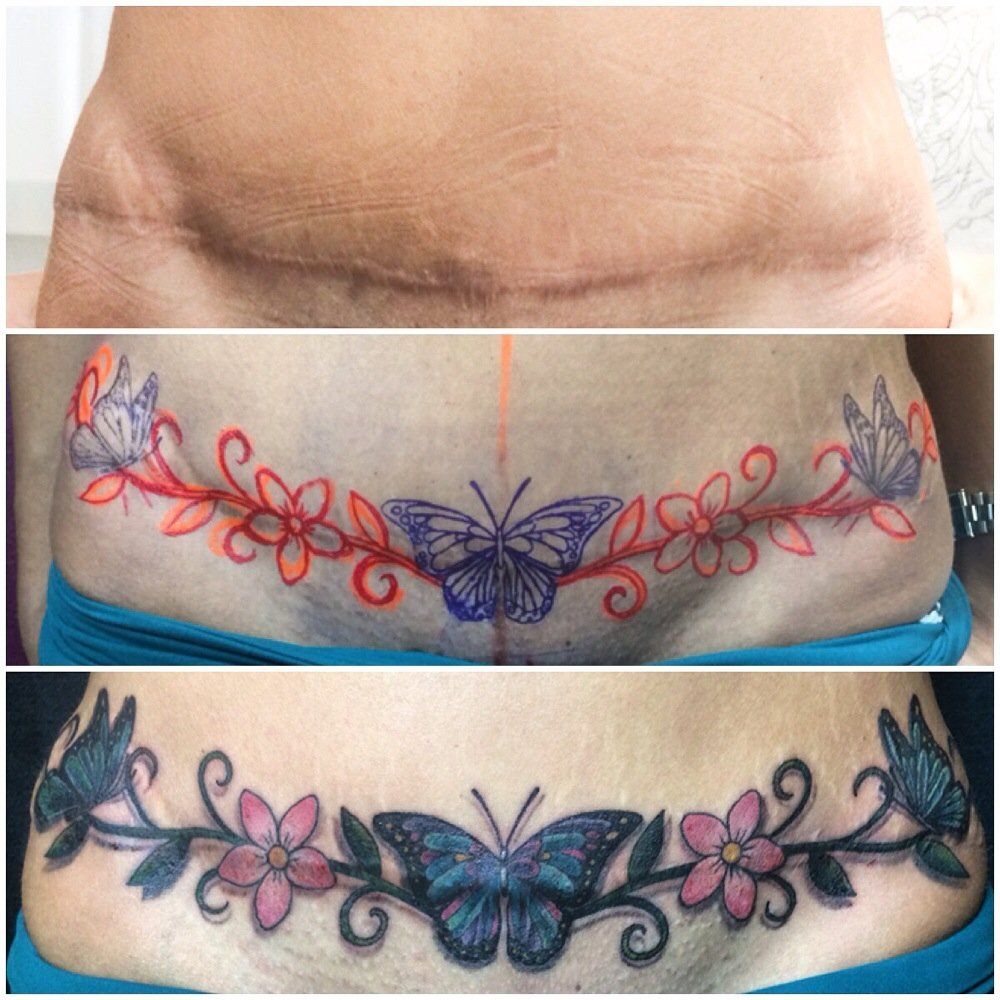 tummy tuck tattoo ideas 0030