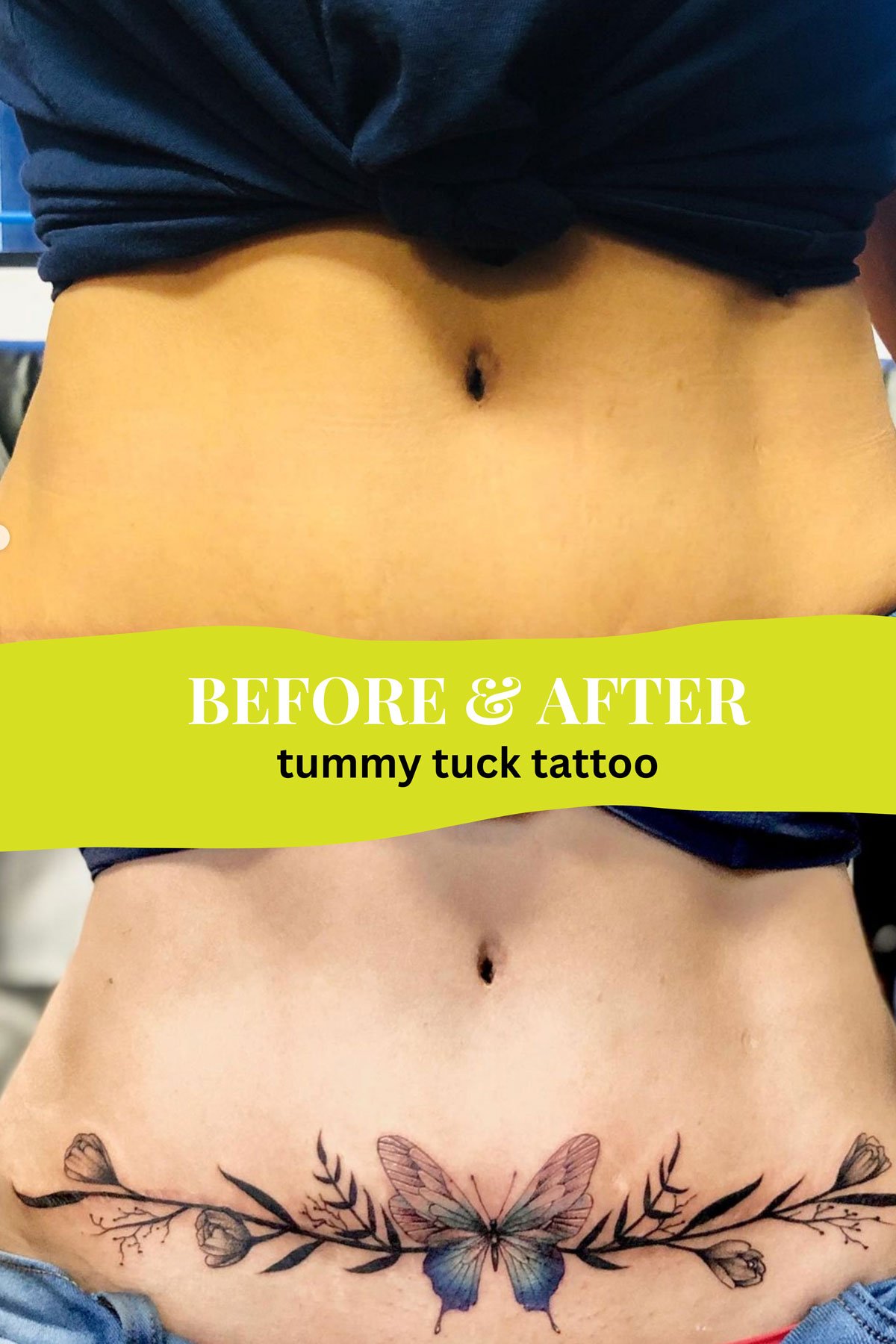 Tummy tuck tattoo ideas embodying beauty and self-empowerment through art